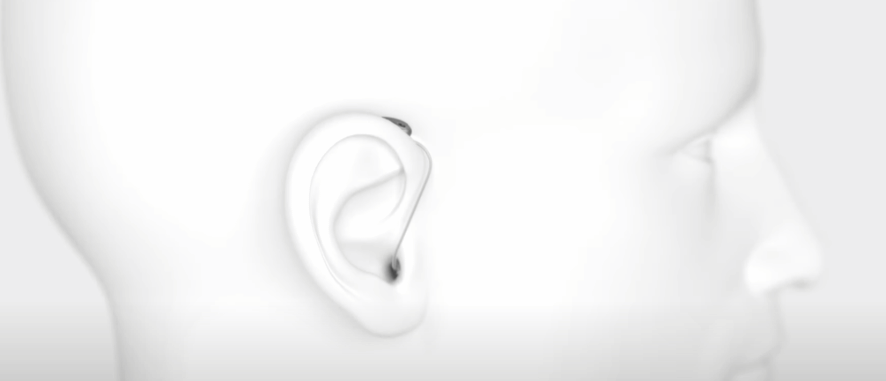 Hearing Aids for Small or Narrow Ear Canals: Finding the Perfect Fit | Aanvii Hearing Hearing Aids for Small or Narrow Ear Canals: Finding the Perfect Fit | Aanvii Hearing